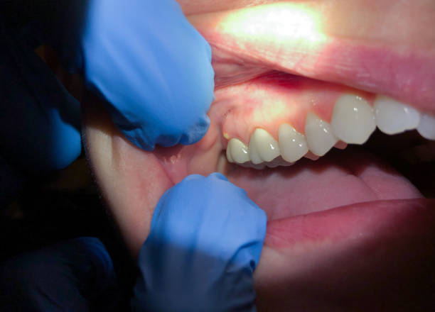 Best After-Hours Dental Trauma Care in Hustisford, WI