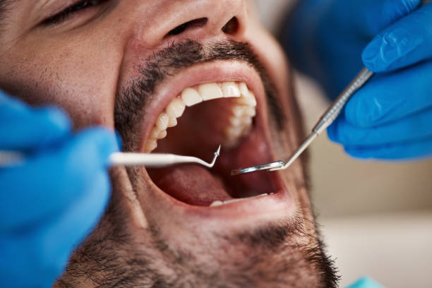 Best Emergency Treatment for Dental Infections or Abscesses in Hustisford, WI