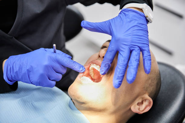 Best Emergency Wisdom Teeth Removal in Hustisford, WI